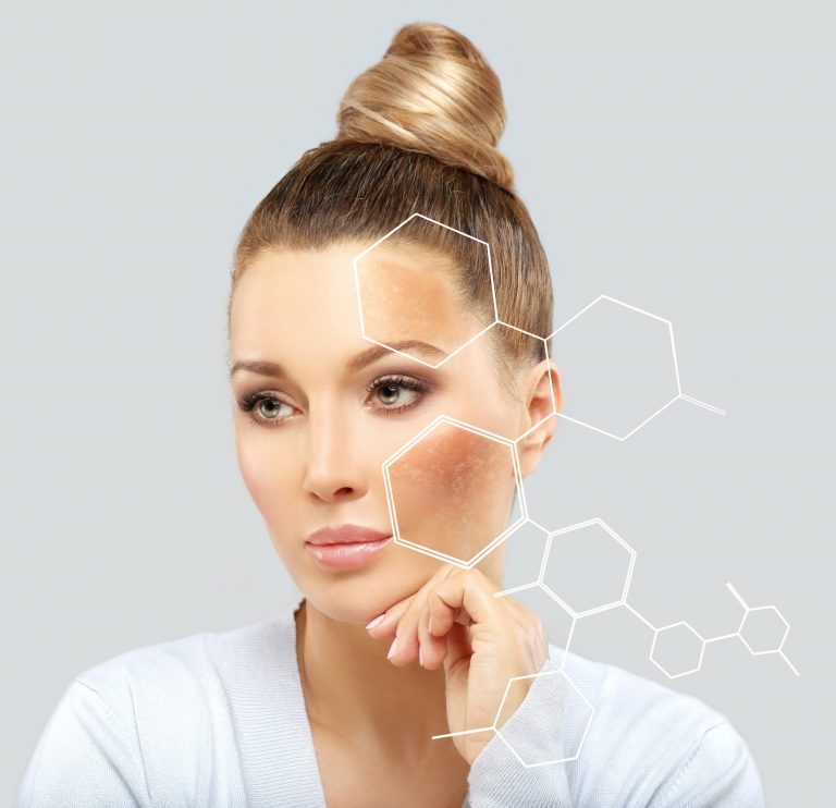 ¿MANCHAS?: TIPS PARA CUIDAR TU ROSTRO DE LA HIPERPIGMENTACIÓN
